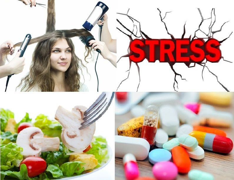 Stress gây tổn thương cho nang tóc - cách trị rụng tóc rụng tóc