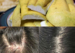 Cách trị nấm da đầu bằng vỏ bưởi