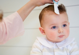 Hiểu rõ về tình trạng rụng tóc ở trẻ sơ sinh