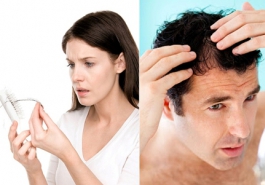 Phụ nữ hay nam giới quan tâm đến tình trạng rụng tóc nhiều hơn?