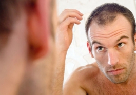 Rụng tóc – Những điều cần phải biết