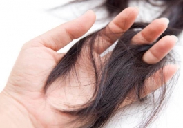 Rụng tóc quá nhiều ở nữ và cách khắc phục hiệu quả nhất
