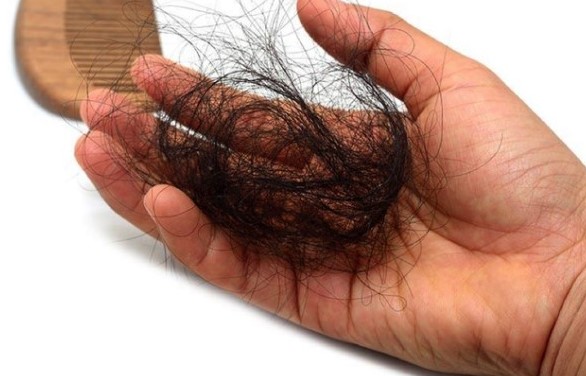 Cách chữa rụng tóc và kích thích mọc tóc 
