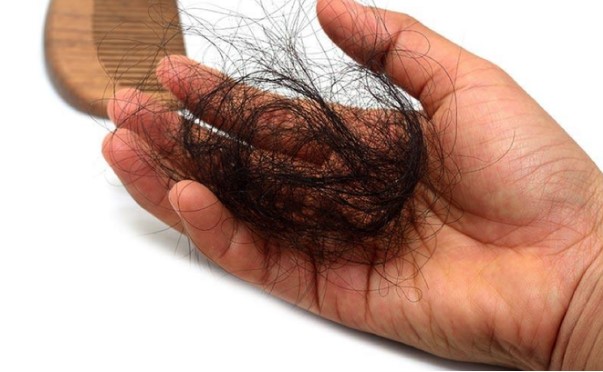 Cần tìm phương pháp khắc phục nếu tóc rụng nhiều
