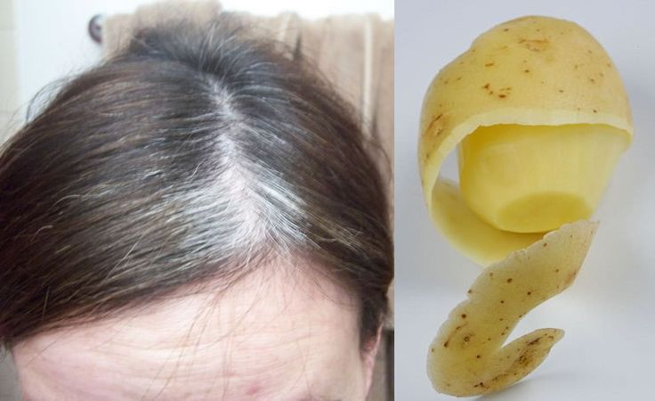 Vỏ khoai tây giúp ngăn chặn tóc bạc sớm