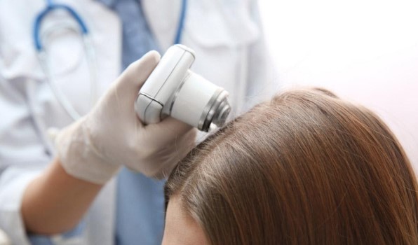 Đến bác sỹ điều trị kịp thời các bệnh về da đầu