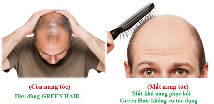 Còn nang tóc hãy dùng Green Hair