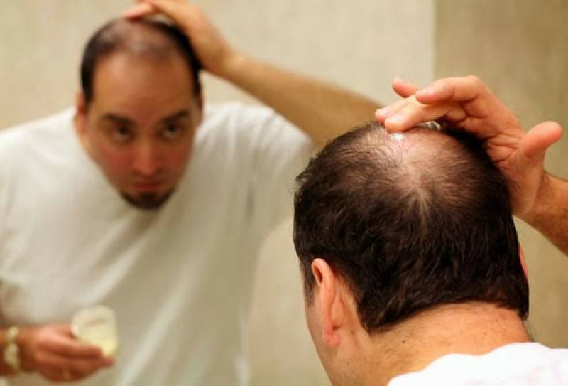 thuốc ngăn rụng tóc có thể gây rối loạn chức năng tình dục