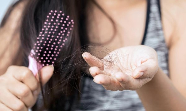 Những yếu tố cần quan tâm trong quá trình chữa bênh rụng tóc