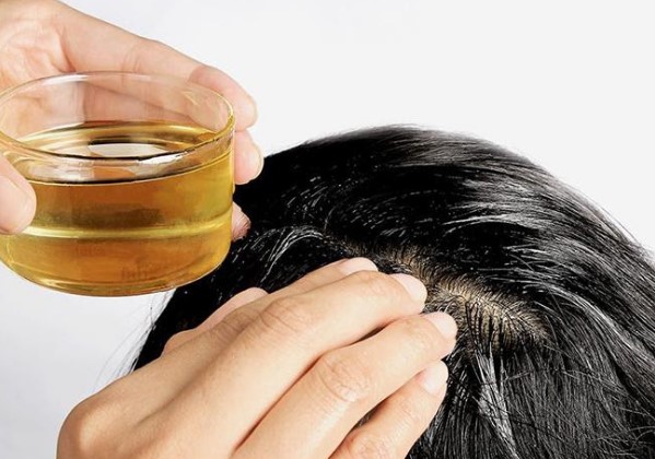 Phương pháp trị rụng tóc hiệu quả
