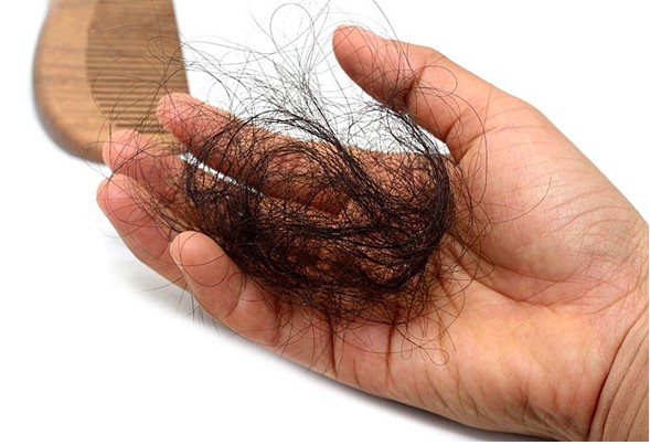Rụng trên 100 sợi là rụng tóc bệnh lý