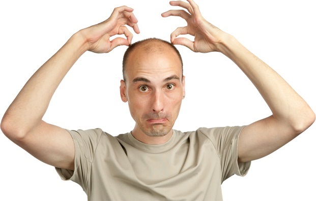rụng tóc do di truyền chỉ gặp ở nam giới
